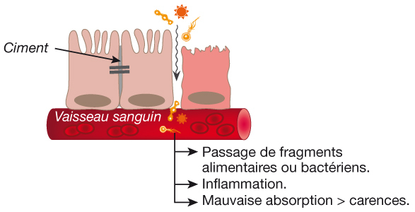 Etancheite cellules intestin